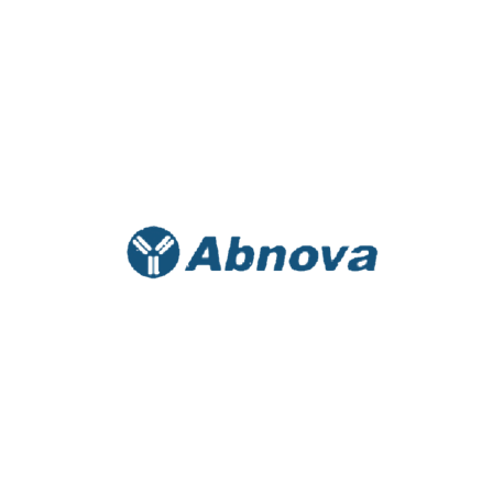 ALDOA 293T Cell Transient Overexpression Lysate(Denatured)